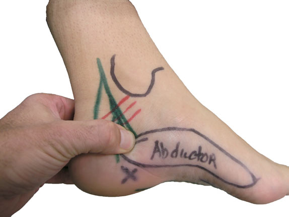 inner ankle and heel pain